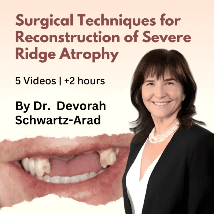 Surgical Techniques for Reconstruction of Severe Ridge Atrophy - Dental ...