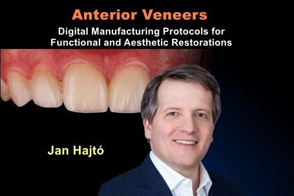 Anterior-Veneers_Digital-Manufacturing-Protocols-for-Functional-and-Aesthetic-Restorations.jpg