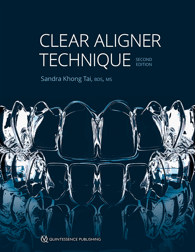 cover_tai_clear_aligner_technique_2ndedition_650pix@2x.b5002615