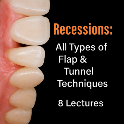 Recessions: All Types of Flap & Tunnel Techniques